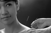 Bondi Acupuncture image 1